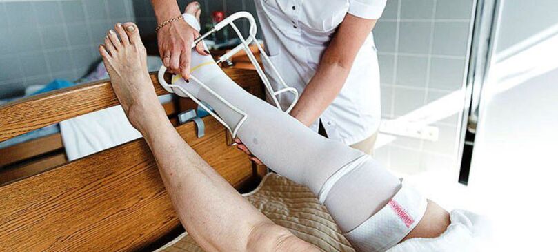 Bas de contention pour le traitement des varices